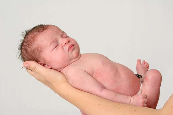 Пуповина у новорожденных может отпадать в разное время в зависимости от физиологии ребенка 
