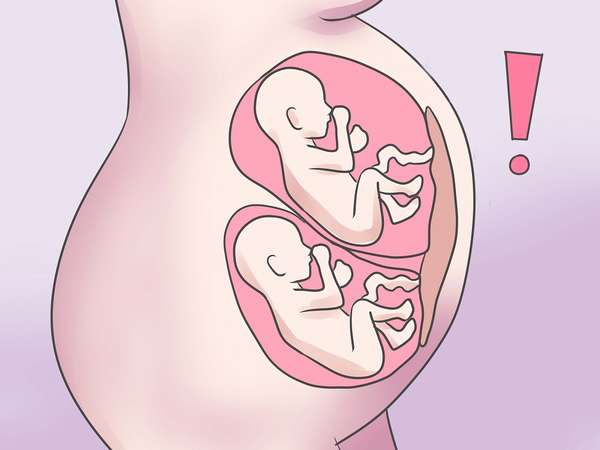 Быстрое увеличение объема живота беременной женщины - один из признаков двухплодной беременности