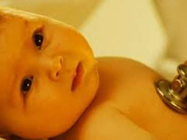 Диагностика желтухи новорожденных, в первую очередь, основывается на визуальном осмотре новорожденного, а потом уже на измерении уровня билирубина в крови