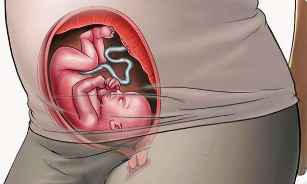 В 24 недели у ребенка хорошо развита мышечная ткань конечностей
