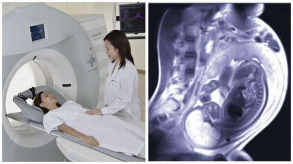 Магнитно-резонансная томография — один из самых безопасных методов современной медицинской диагностики
